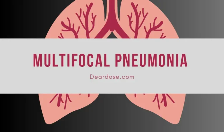 multifocal pneumonia - deardose